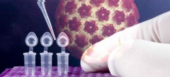 Diagnosis HPV menggunakan ujian digene