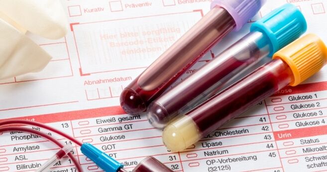 Ujian darah untuk papillomavirus manusia